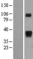 RCAN1 / DSCR1 Protein (Over-Expression Lysate Myc-DDK (Flag))