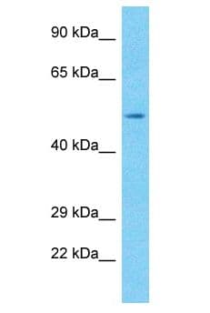RBMY1A1 Antibody (aa446-495)