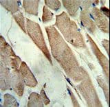 CKM / Creatine Kinase MM Antibody (aa283-313)