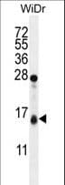 TOMM20L Antibody (aa15-44)