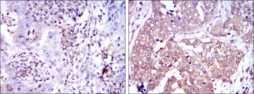 NFKB1 / NF-Kappa-B Antibody (clone 5D10D11)