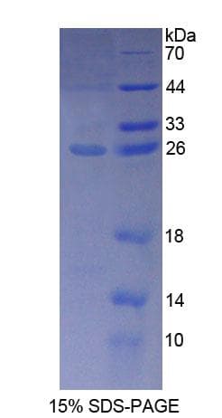 Human PGM1 / Phosphoglucomutase 1 Protein (Recombinant His-T7)