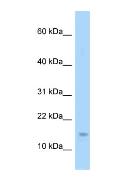 Polyclonal Rabbit anti-Mouse EIF4EBP1 / 4EBP1 Antibody (aa21-70, WB)