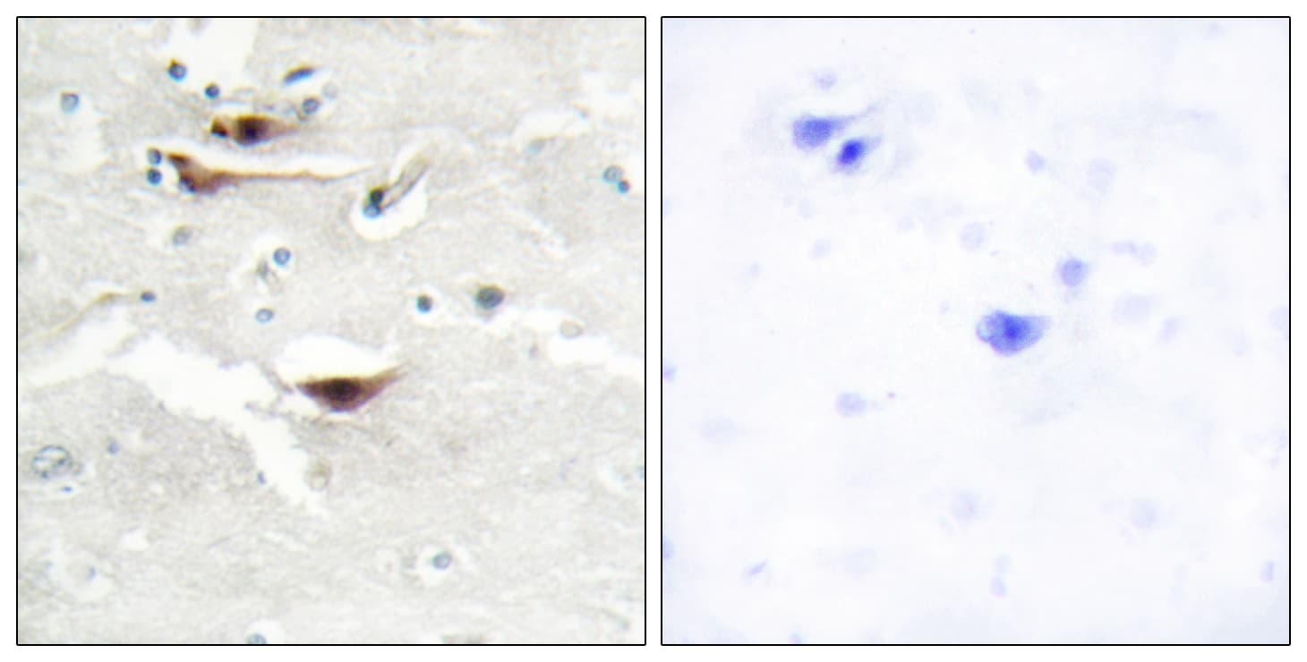 IPPK Antibody (aa11-60)