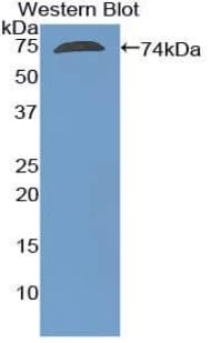 ACTG1 / Gamma Actin Antibody (aa1-375, PE)