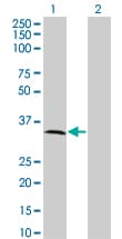 MPPED2 Antibody (clone 2G1-1B7)