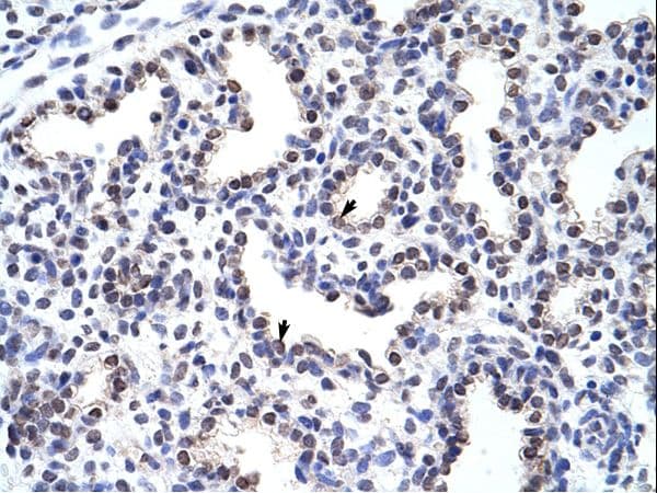 Polyclonal Rabbit anti-Human WNT2B Antibody (aa229-278, IHC, WB)