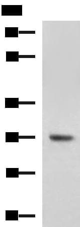 DHRS2 / HEP27 Antibody