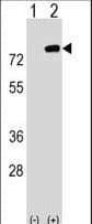 Polyclonal Rabbit anti-Human PBXIP1 / HPIP Antibody (aa472-501, WB)