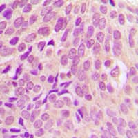 RPS6 / Ribosomal Protein S6 Antibody (C-Terminus)
