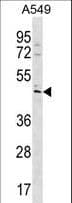 TBC1D20 Antibody (aa335-363)