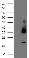 UNG / Uracil DNA Glycosylase Antibody (clone OTI1F8)
