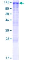 Human CWC22 Protein (Recombinant GST)