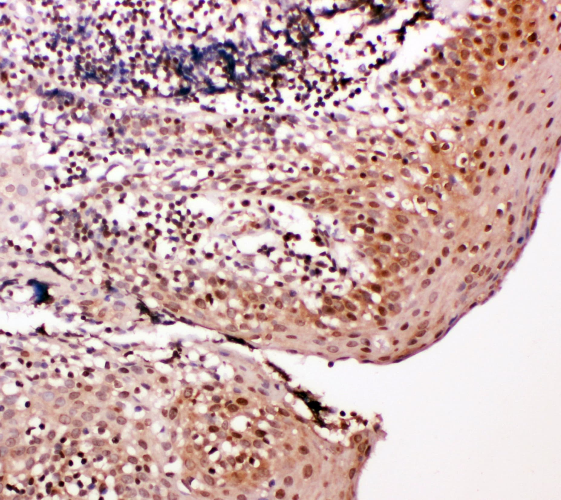 CASP14 / Caspase 14 Antibody (aa223-242)