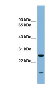 TRAPPC4 / Synbindin Antibody (aa107-156)