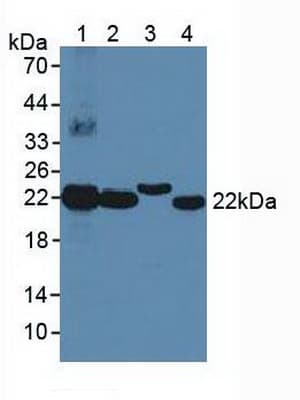 GHBP / BLVRB Antibody (aa2-206, PE)