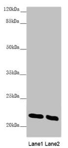 Polyclonal Rabbit anti-Human AK1 / Adenylate Kinase 1 Antibody (IHC, WB)