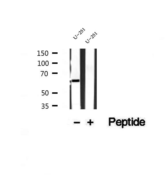 Polyclonal Rabbit anti-Human SHOC2 Antibody (IHC, WB)