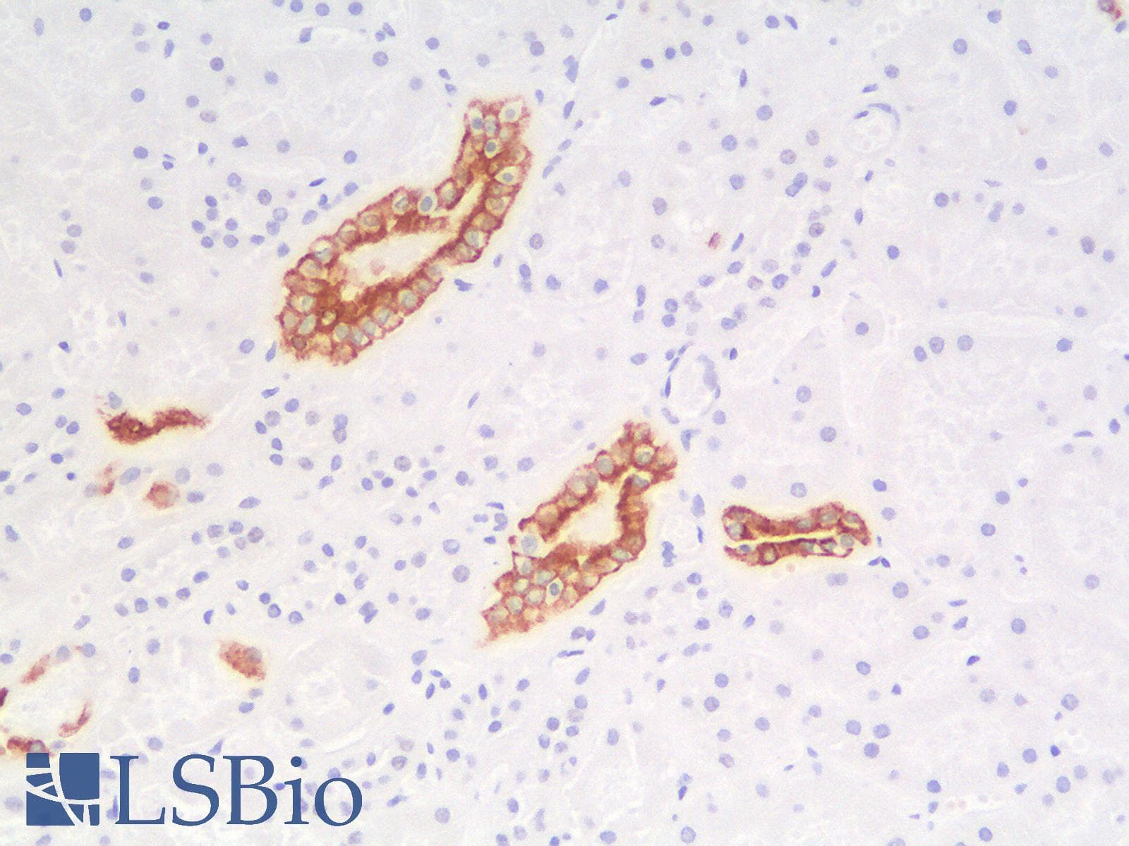 PathPlus™ KRT19 / CK19 / Cytokeratin 19 Antibody (clone rKRT19/799)