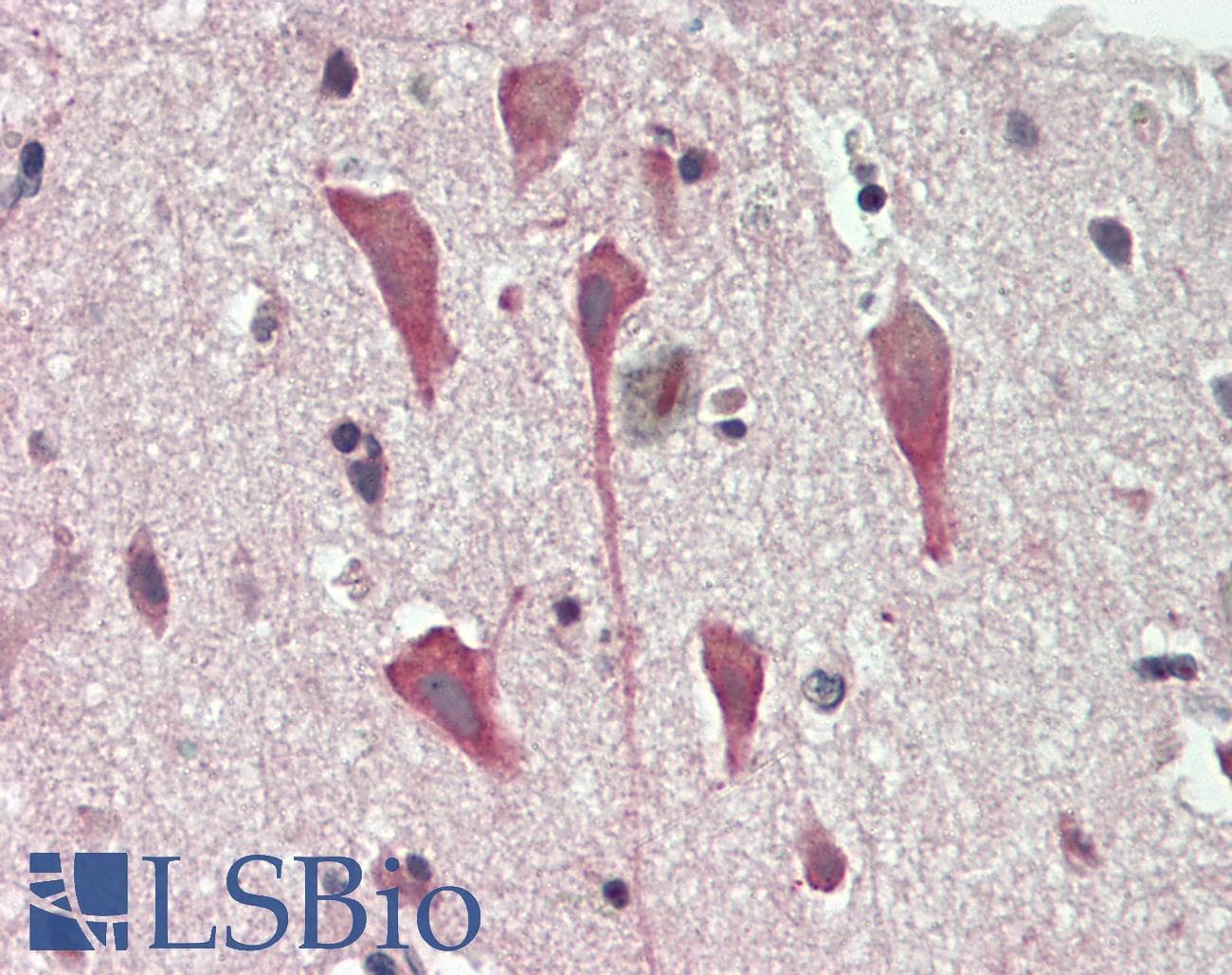 CNTNAP1 / CASPR / p190 Antibody (aa926-1190)
