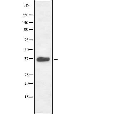 RAD51 / RECA Antibody