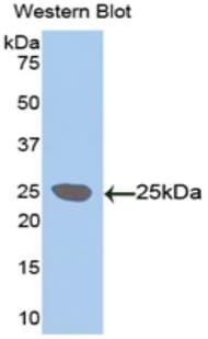 LOXL1 Antibody (aa369-574)