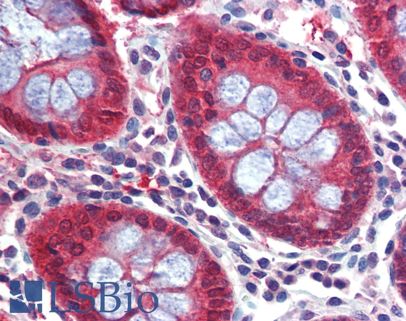 IHC-plus™ Polyclonal Rabbit anti-Human CASP7 / Caspase 7 Antibody (IHC, WB)