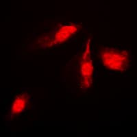 MAP2K4 / MKK4 Antibody (Internal)