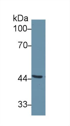 SERPINA6 / CBG Antibody (aa280-405)