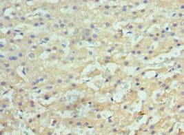 Polyclonal Rabbit anti-Human HYOU1 / ORP150 Antibody (aa1-140, IHC)