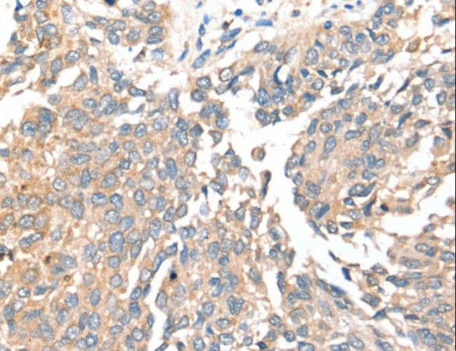 SIRT4 / Sirtuin 4 Antibody