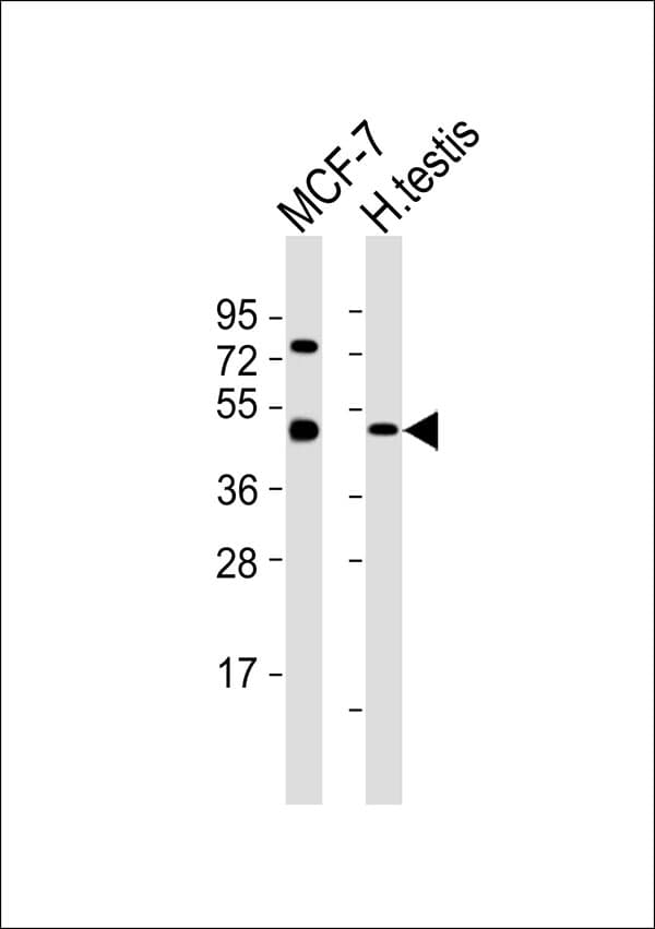 TADA2L / ADA2A Antibody