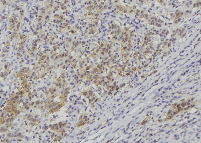 CRLF1 Antibody