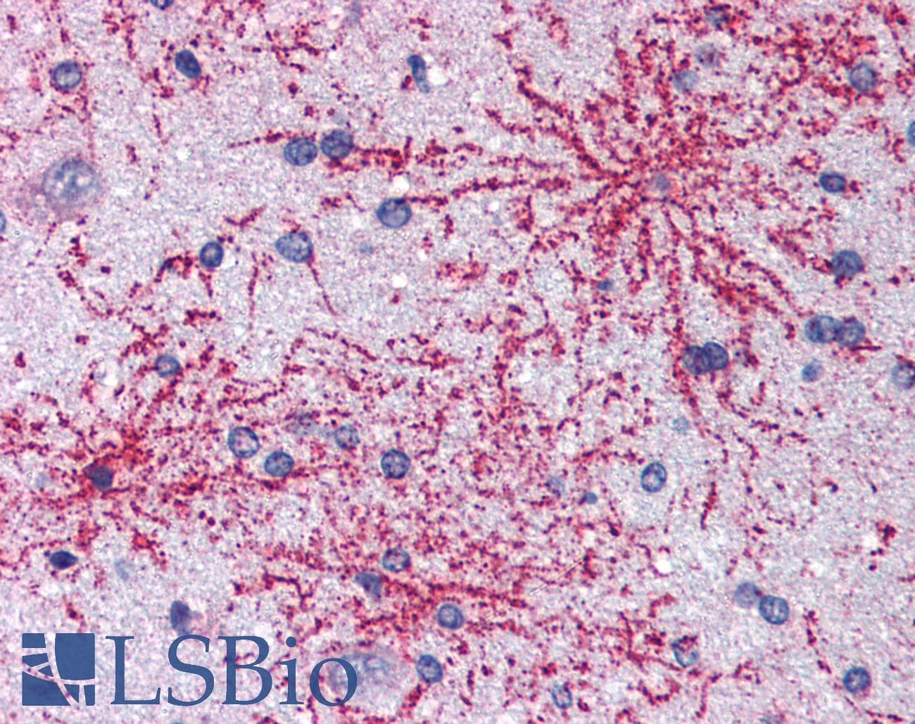 IHC-plus™ Polyclonal Goat anti-Human BAIAP2 / IRSP53 Antibody (Isoform 1, IHC, WB)