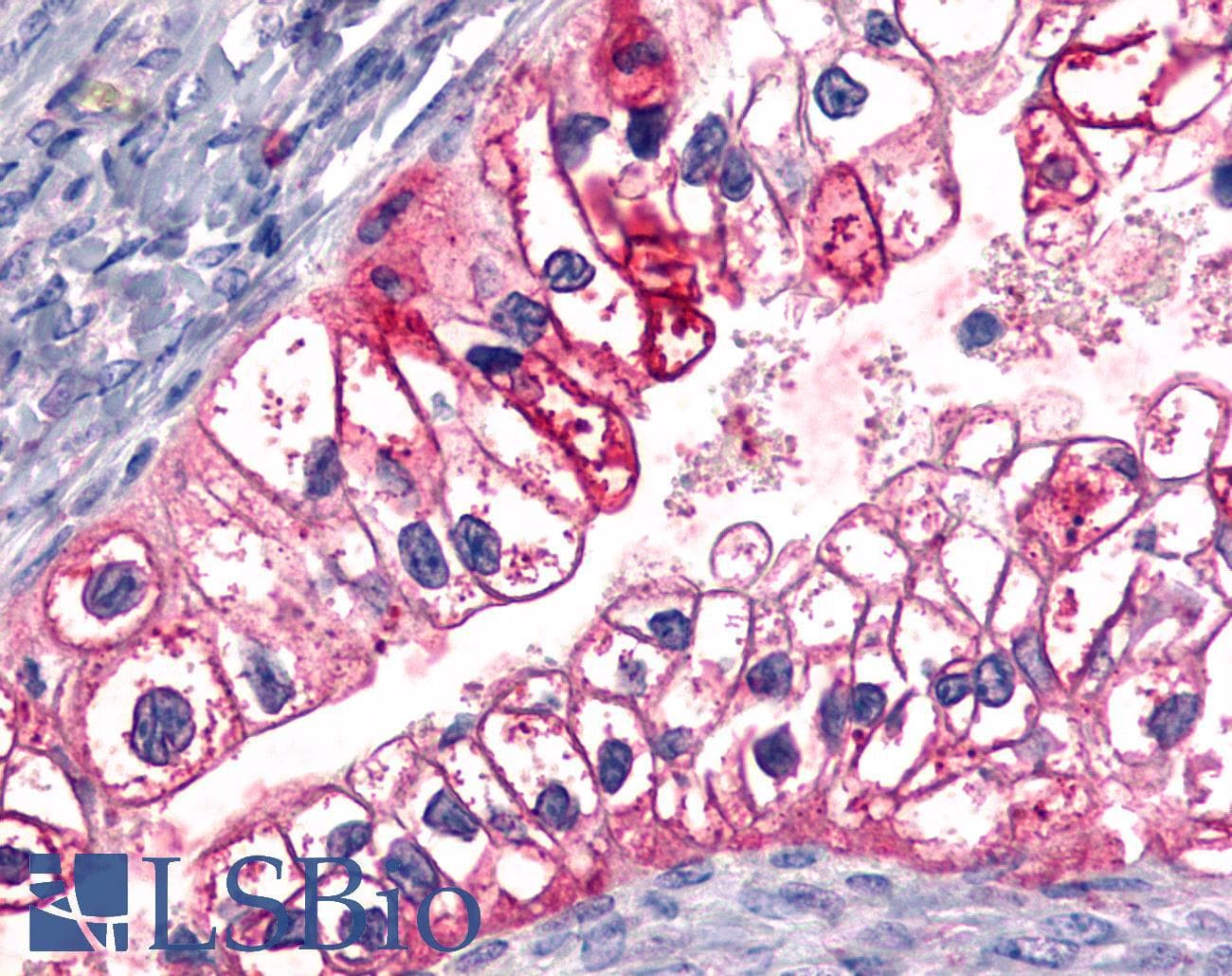 PathPlus™ ADGRL4 / ELTD1 Antibody (N-Terminus)