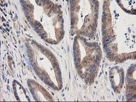 MAPRE2 / EB2 Antibody (clone OTI1D10)
