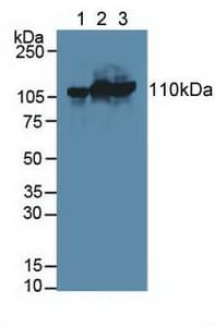 HK3 / Hexokinase 3 Antibody (aa673-903, PE)