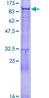 Human FBXO40 Protein (Recombinant GST)