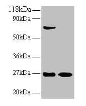 IFN Gamma / Interferon Gamma Antibody