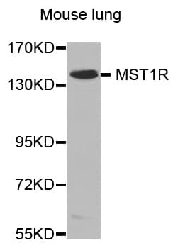 MST1R / RON Antibody