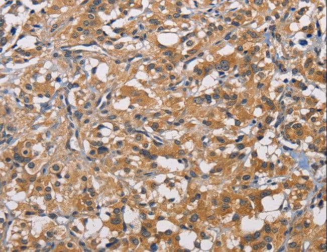 PIKFYVE / PIP5K Antibody