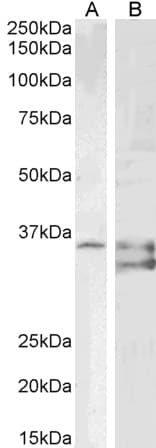 IHC-plus™ Polyclonal Goat anti-Human SGTA / SGT Antibody (Internal Region, IHC, WB)
