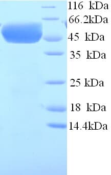 Human CHGA / Chromogranin A Protein (Recombinant His)