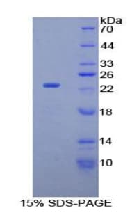 Mouse FBN1 / Fibrillin 1 Protein (Recombinant His)