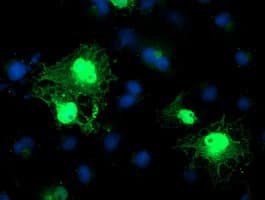 C1orf50 Antibody (clone OTI1C6)