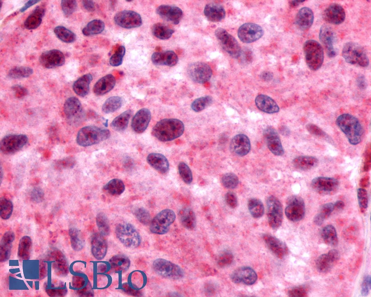 PathPlus™ GPR162 Antibody (Extracellular Domain)