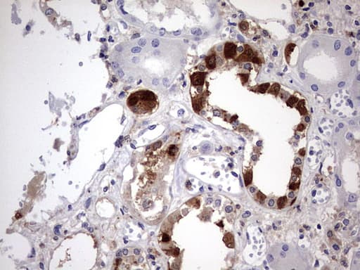 LGALS3 / Galectin 3 Antibody (clone OTI1C7)
