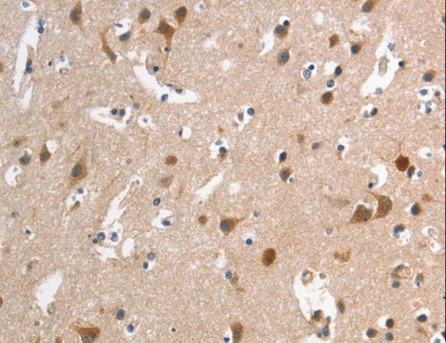 HMMR / CD168 / RHAMM Antibody