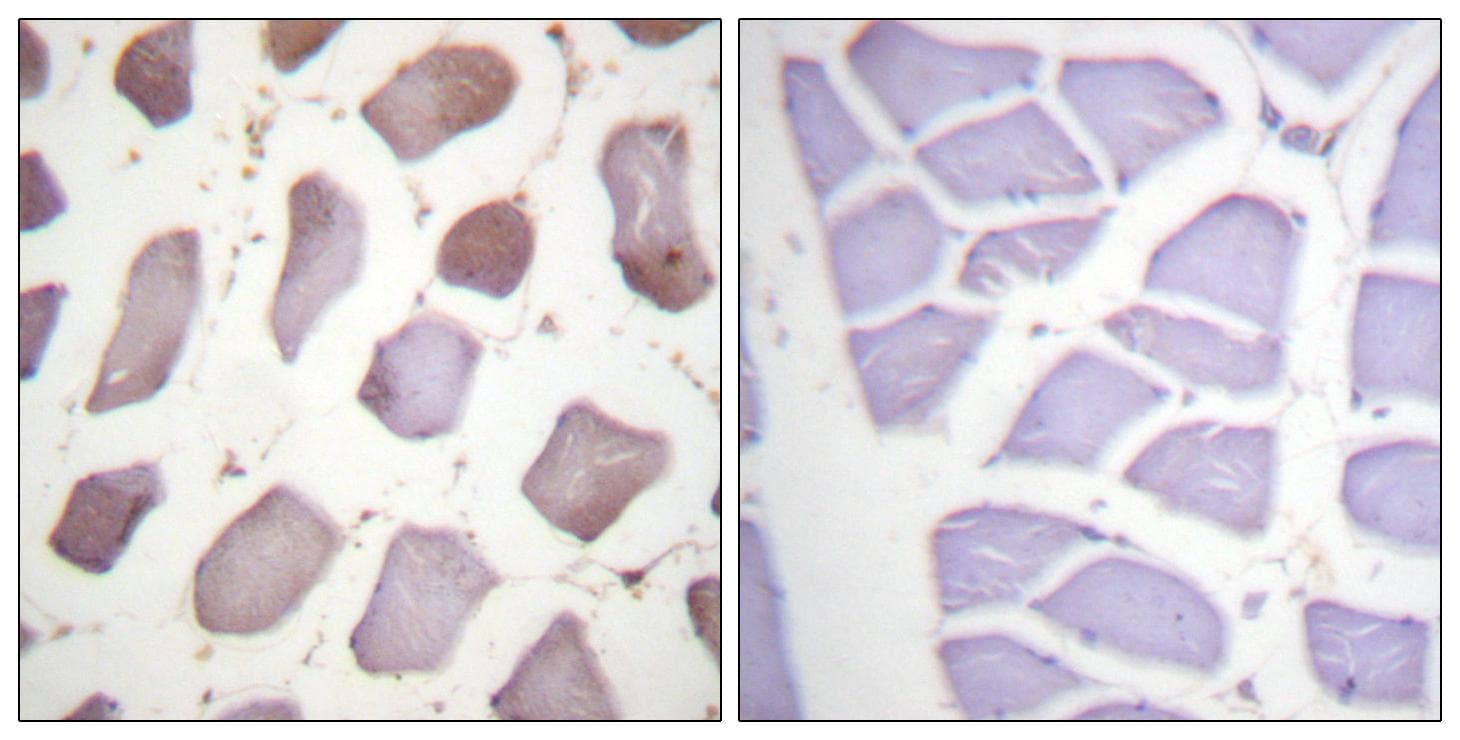 Polyclonal Rabbit anti-Human PRKAB1 / AMPK Beta 1 Antibody (p181, IHC, WB)