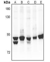 Polyclonal Rabbit anti-Human PRKCA / PKC-Alpha Antibody (IHC, WB)